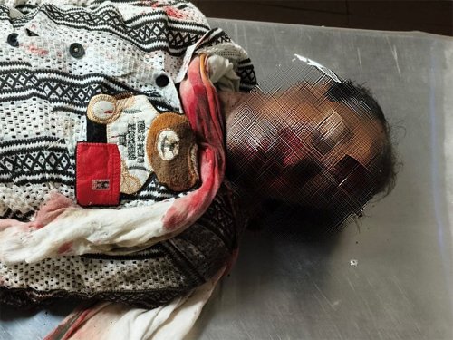 सड़क हादसे में एक की मौत, चार घायल, शराब व तेज रफ्तार बनी वजह